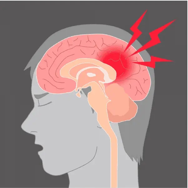 Image representing regenerative medicine research for stroke